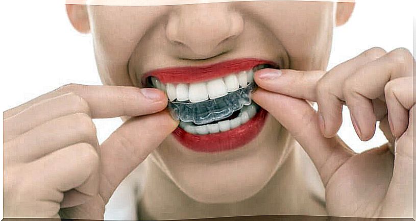 Woman with dental protection