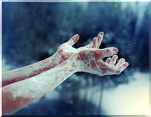 Frozen hands